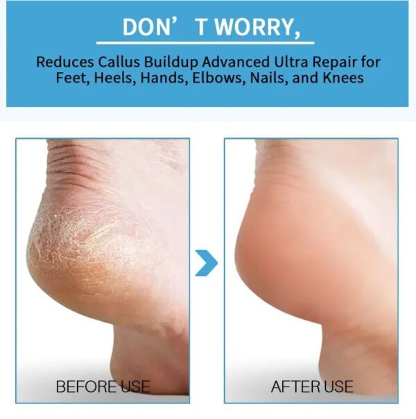 Foot Peeling Spray with Natural Essence Pedicure - Image 7