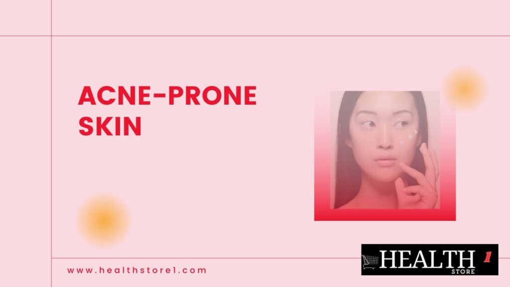 acne prevention