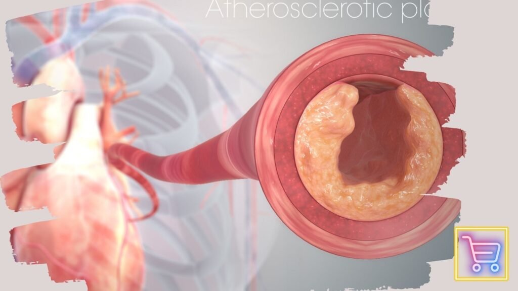 A detailed cross-section showing an artery blocked by fatty deposits due to obesity, highlighting restricted blood flow and cholesterol buildup.